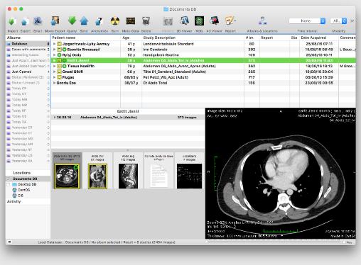 OsiriX DICOM Viewer